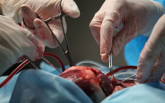 Lee más sobre el artículo Dan luz verde a Hospital Santa Bárbara de Sucre para realizar trasplantes de riñón