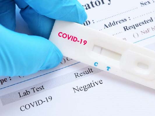 Lee más sobre el artículo Con 87 nuevos positivos Bolivia suma 1.681 casos de coronavirus; Santa Cruz y Beni preocupan
