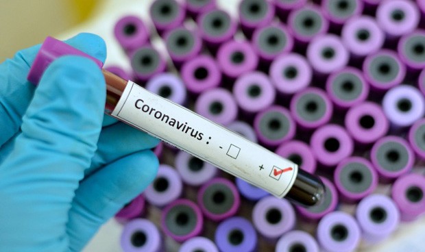 Lee más sobre el artículo Bolivia suma 6.660 infectados y 647 pacientes recuperados de Covid-19