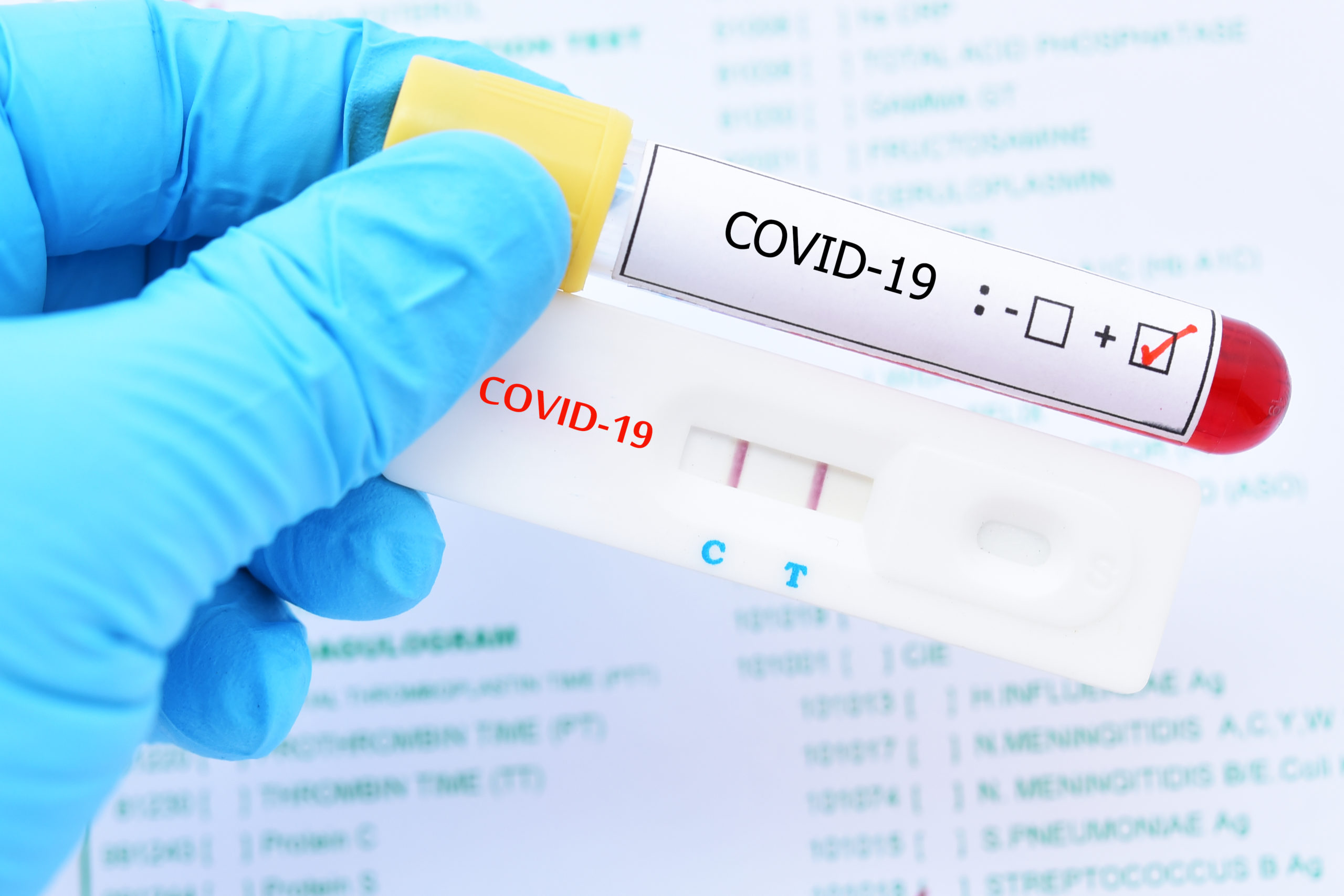 Lee más sobre el artículo Casi medio millón de pruebas para Covid-19 llegaran al país desde el 30 de junio