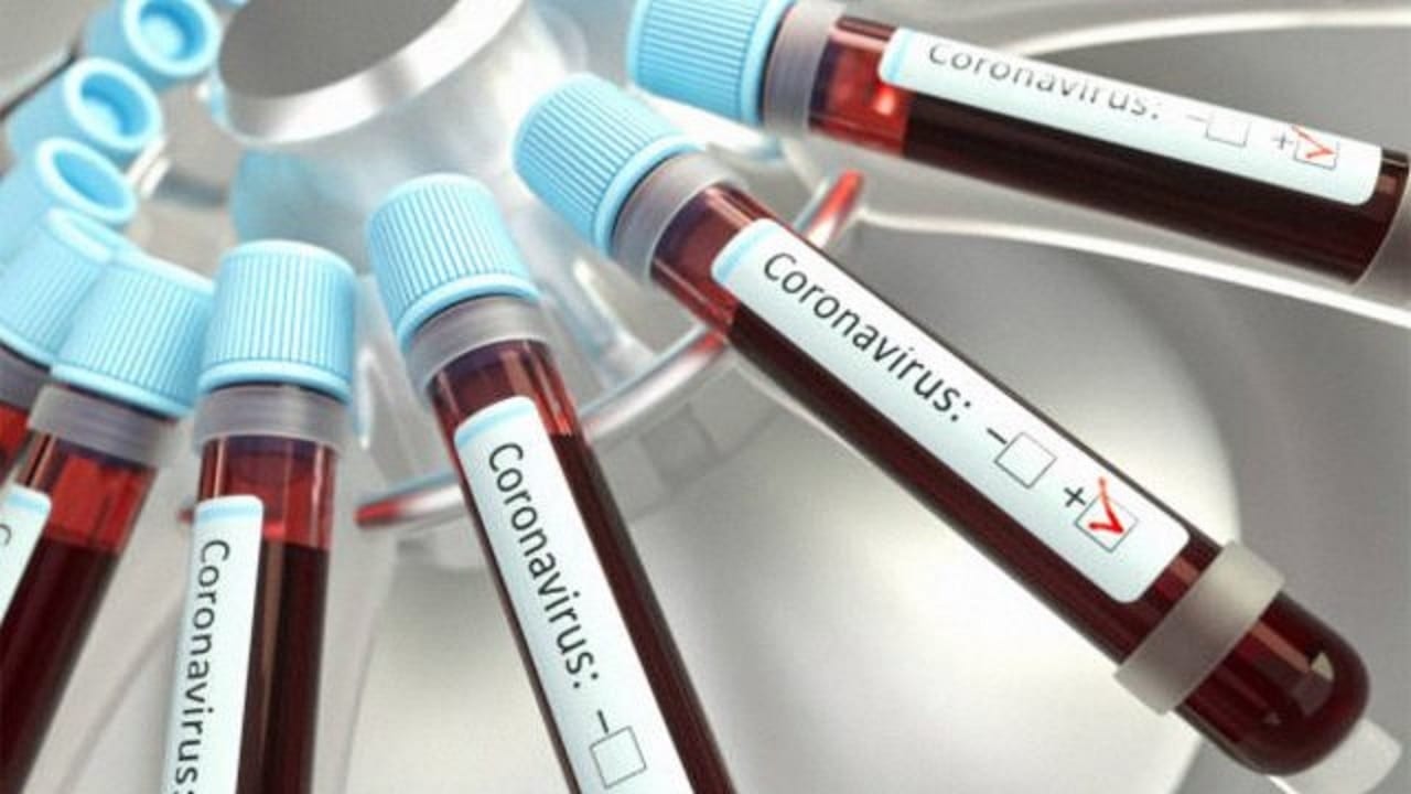 Lee más sobre el artículo Aprobación de vacuna para COVID-19 en Rusia es inminente