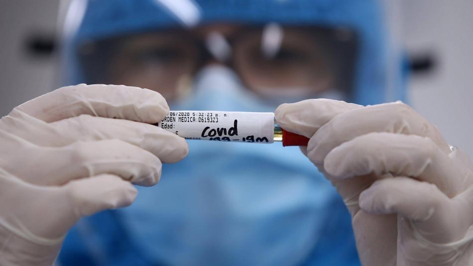 Lee más sobre el artículo Seis posibles casos de reinfección de coronavirus en Beni y La Paz.