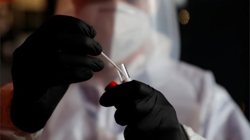 Lee más sobre el artículo Nueva cepa de coronavirus: Francia confirma su primer caso de la variante identificada en Reino Unido