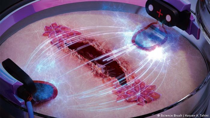 Lee más sobre el artículo Descubren método para curar heridas tres veces más rápido usando electricidad