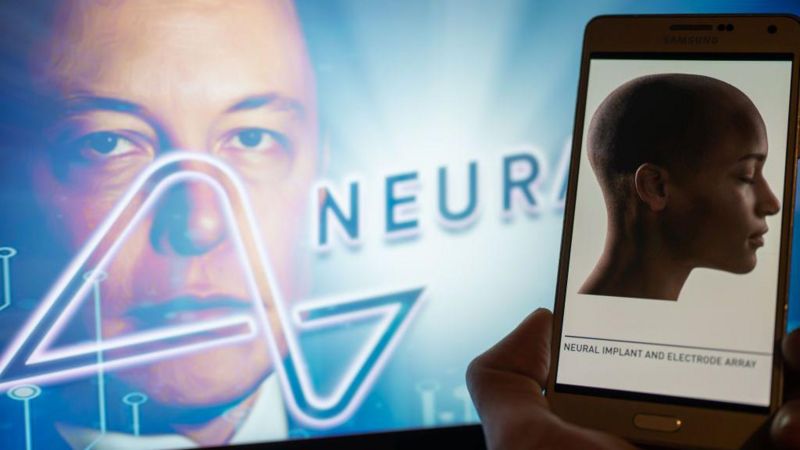 Lee más sobre el artículo Elon Musk anuncia el primer implante de un chip de su compañía Neuralink en el cerebro de un humano
